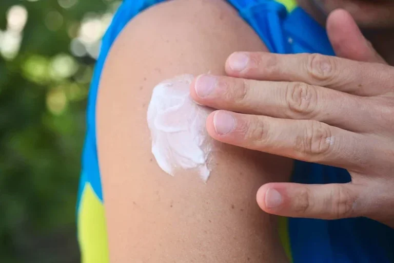 Mosquito repellent creams: Do they harm your skin or protect against dengue and malaria? Experts reveal the truth as mosquito-borne diseases rise in India